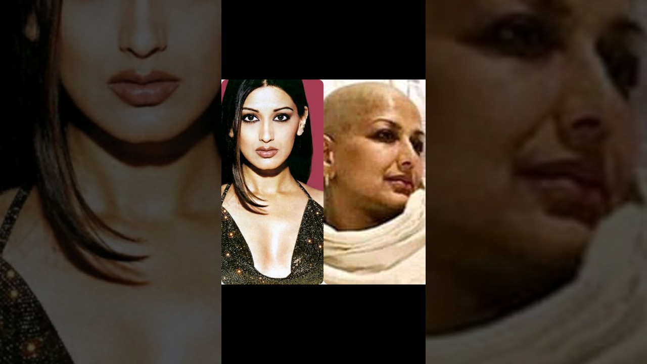 Sonali Bendre During Cancer..😭😞🔥#shorts #viral #cancer #bollywood