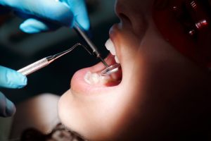 Read more about the article Woman Sues Dentist For Performing Over 30 Surgical Procedures In A Visit