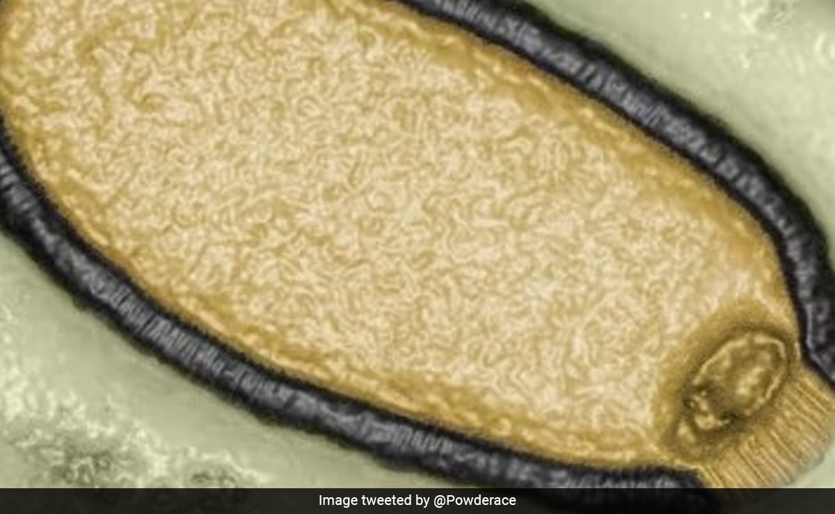 Read more about the article ‘Zombie’ Virus Which Spent 48,500 Years Frozen In Arctic Could Spark Deadly Pandemic, Warn Scientists
