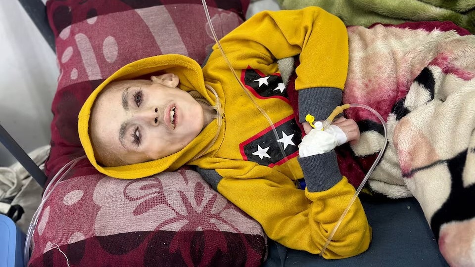 Read more about the article In Gaza, starving children fill hospital wards as famine looms