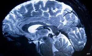 Read more about the article World’s Most Powerful MRI Scans 1st Images Of Human Brain