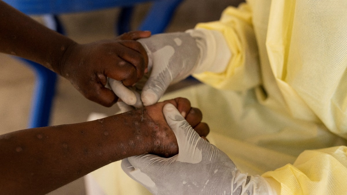 Mpox declared global public health emergency by WHO, second time in 2 years