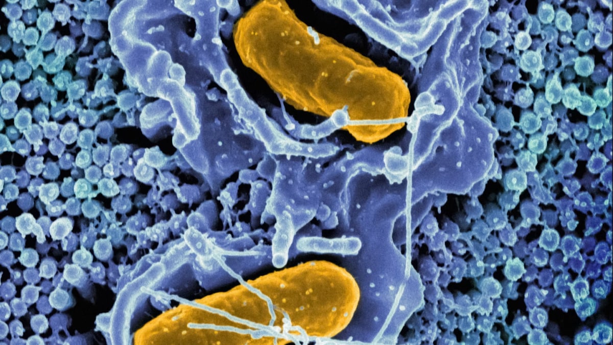 Human Immune System Might Have Evolved From the Ancient Microbe ‘Asgard’, Claims Study