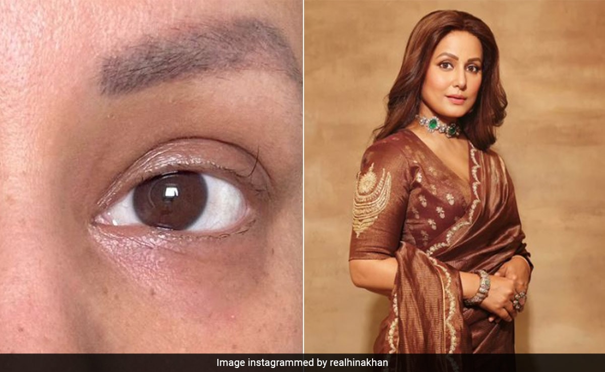 Hina Khan Shares Pics Of Her "Last Standing Eyelash" Amid Cancer Battle: "Haven't Worn Falsies In A Decade"