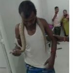 Video: Bihar Man Bitten By Snake Walks Into Hospital With Reptile In Hand