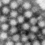 Norovirus resurgence: US stomach virus cases surging