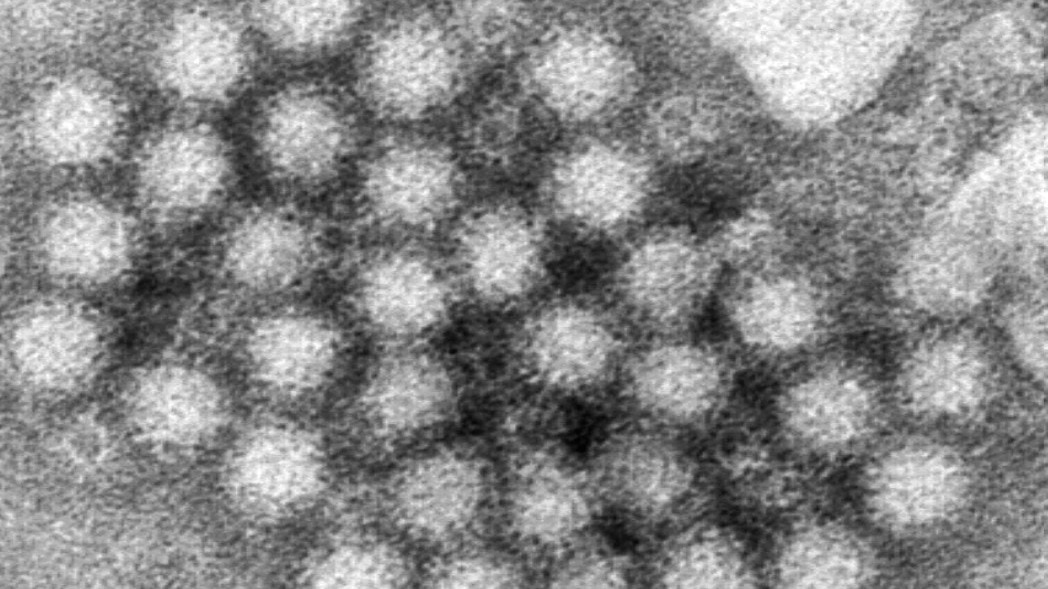 Norovirus wave in US more than double last year’s peak as new strain fuels winter surge: CDC data